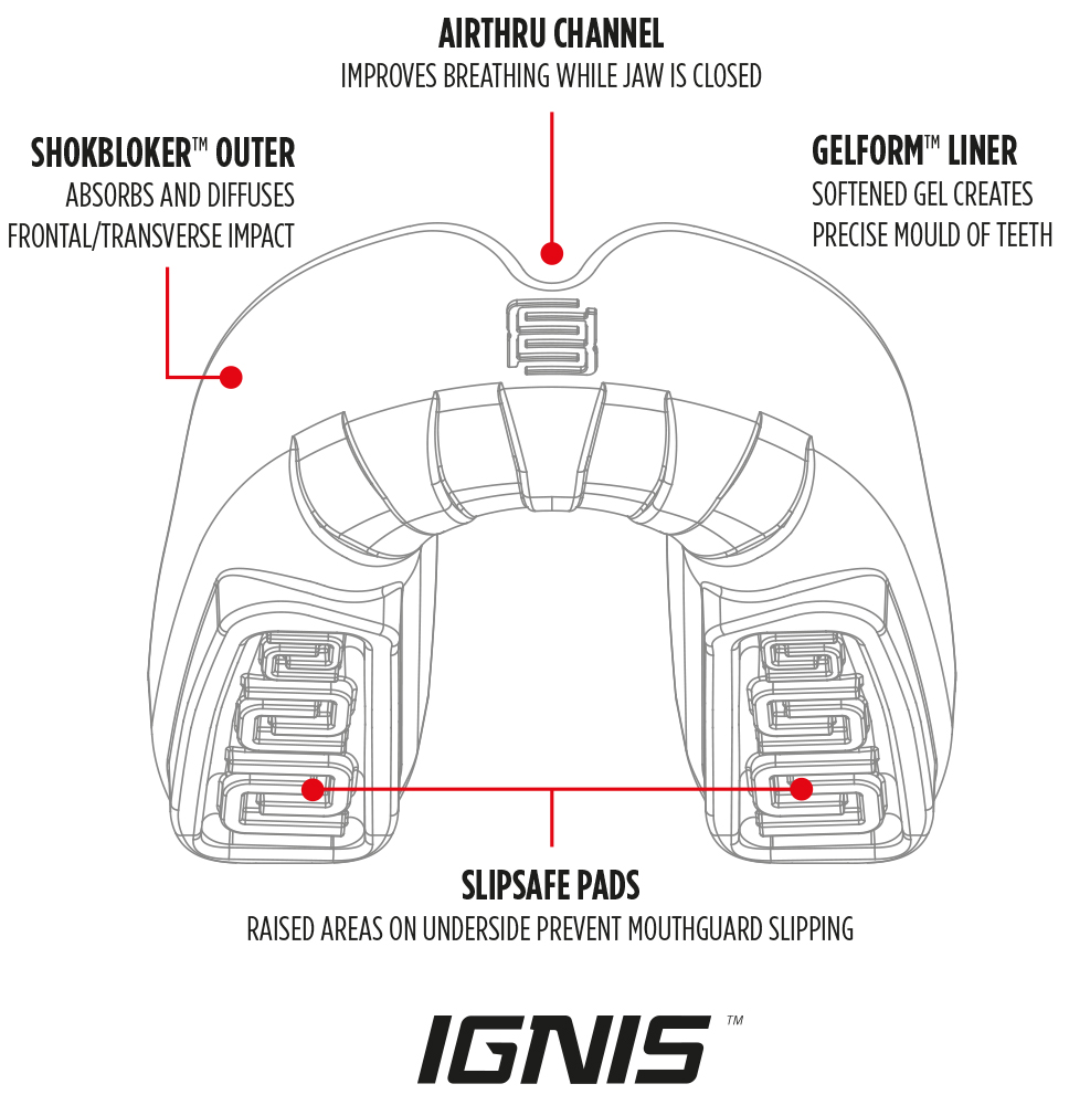 Ignis-unstrapped-diagram